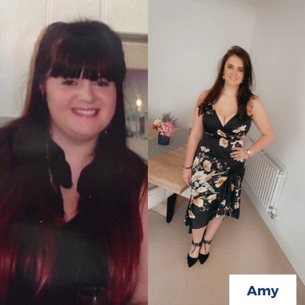 Amy before and after weight loss surgery Weight Loss Surgery Kent